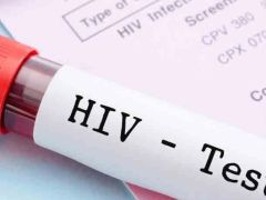 13 yaşındaki çocuk AIDS’ten vefat etti…