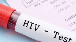 13 yaşındaki çocuk AIDS’ten vefat etti…