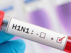 Sağlık çalışanının ölümü endişe yarattı: Domuz gribi (H1N1) hızla yayılıyor!