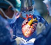 ABD’de neştersiz bypass ameliyatı…..